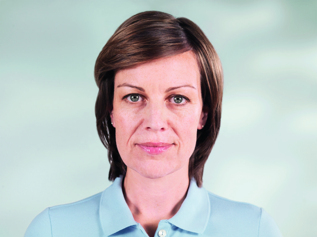 Female patient before sculptra treatment