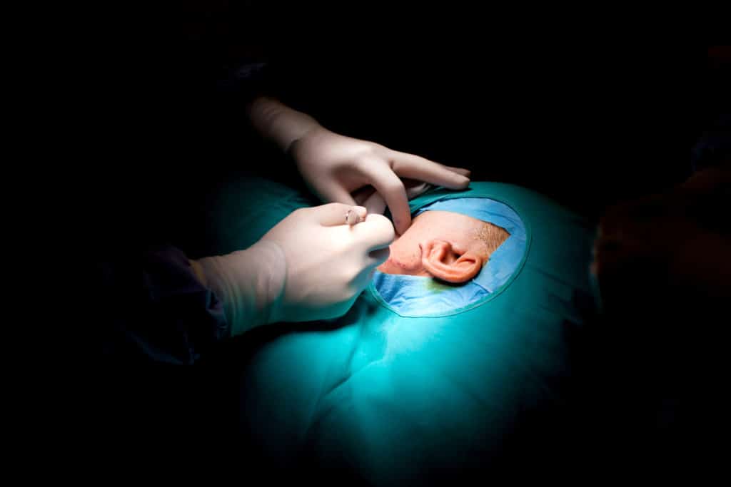 Otoplasty Surgery in West Orange, NJ | Ear Surgery | Citron & Citron